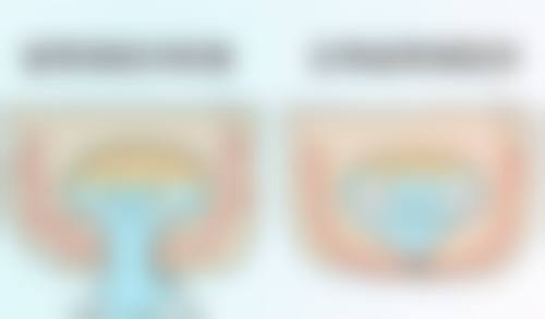 选对医院做双眼皮,为健身早开启助力