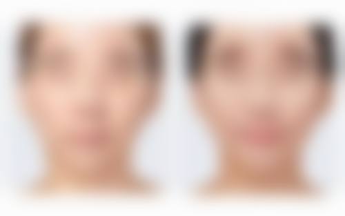 六、福州新世纪整形美容医院价格表：（仅供参考）