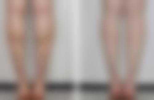 做双眼皮预约流程全解析：轻松搞定预约