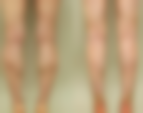 四、南通仁美医疗美容实例