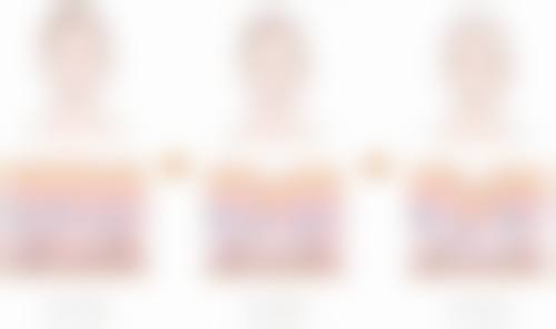 硅胶假体隆胸后能否用手捏?完全修复后触摸也得悠着点