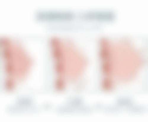 手术出击，重度眼袋不用怕