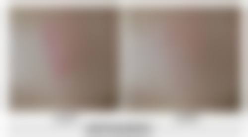 七、汉川丽莱医疗美容医院价格表：（仅供参考）