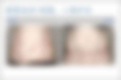 五、福州新世纪整形美容医院怎么预约：