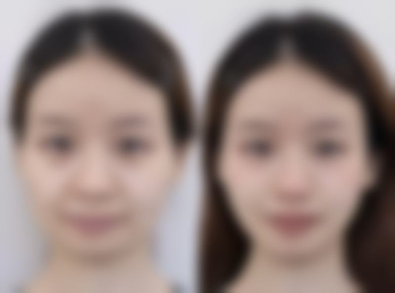 七、杭州雪然慕韵医疗美容诊所真实的顾客评价如下：