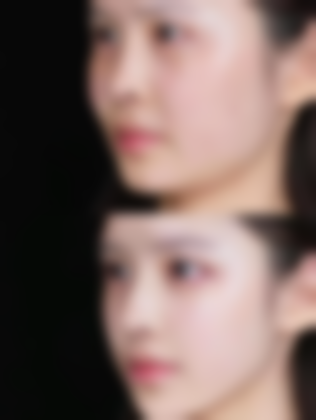 淋巴结肿大时打瘦脸针的风险