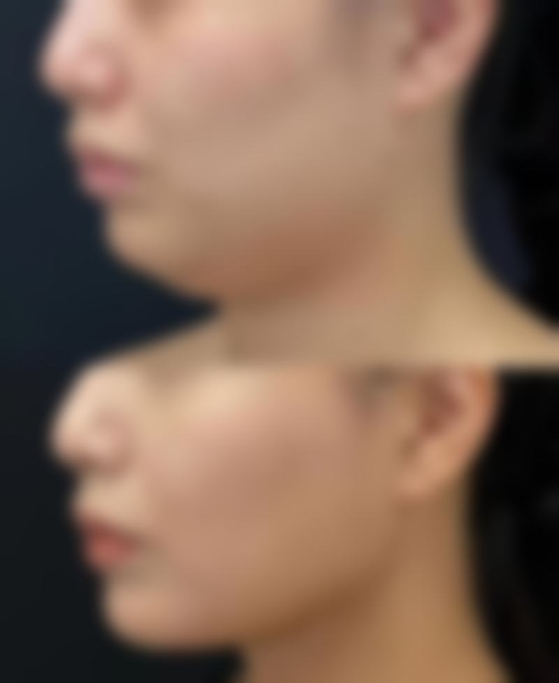 七、咸阳熙沐颜整形医院真实的顾客评价如下: