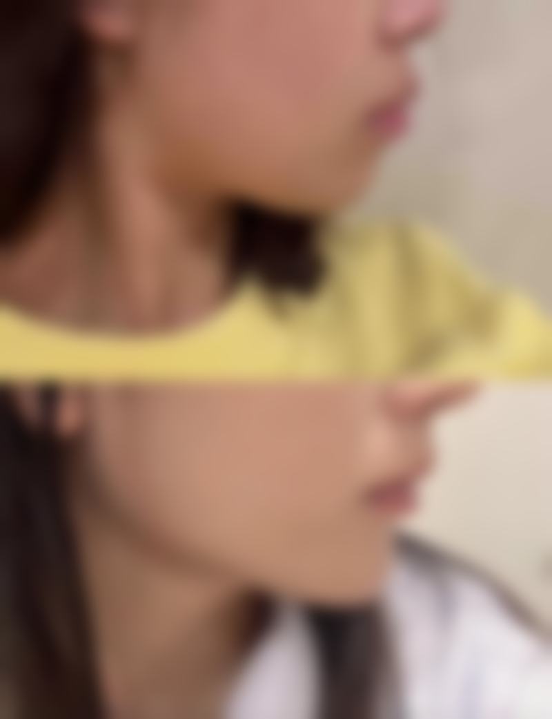 四、杭州雪然慕韵医疗美容诊所实例