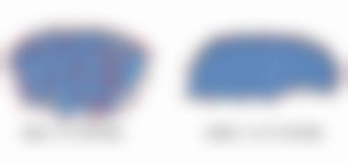 七、韩国傲婷美(OPTIMA)整形外科医院真实的顾客评价如下