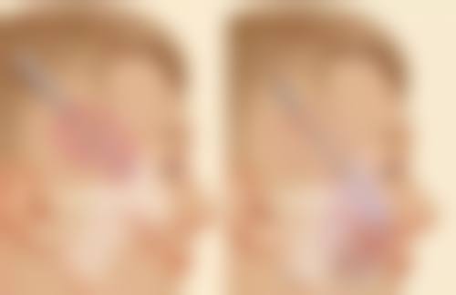 五、济南法熙整形医院实例