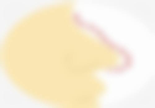 正规医院修复优势：多方式精细调整