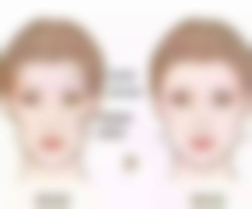 医院专精去眼袋方案大攻略