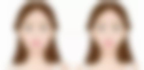 六、景洪泊美雅医疗美容门诊部怎么预约: