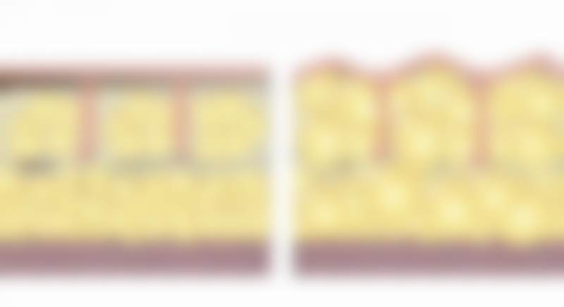 金圣爱眼部整形水平怎么样可靠吗？