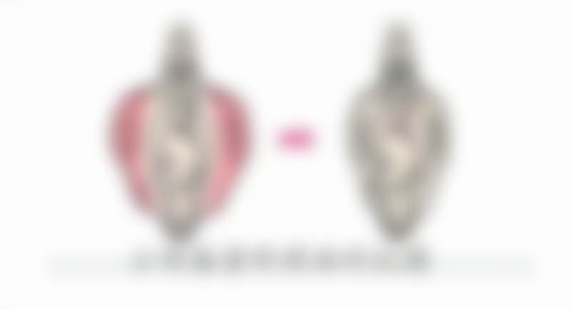 金圣爱眼部整形实例