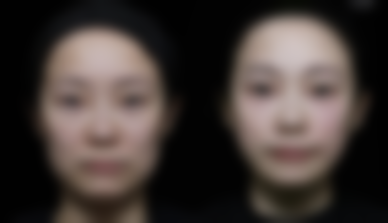 七、上海德琳医疗美容医院乐威男性增粗项目的用户评价