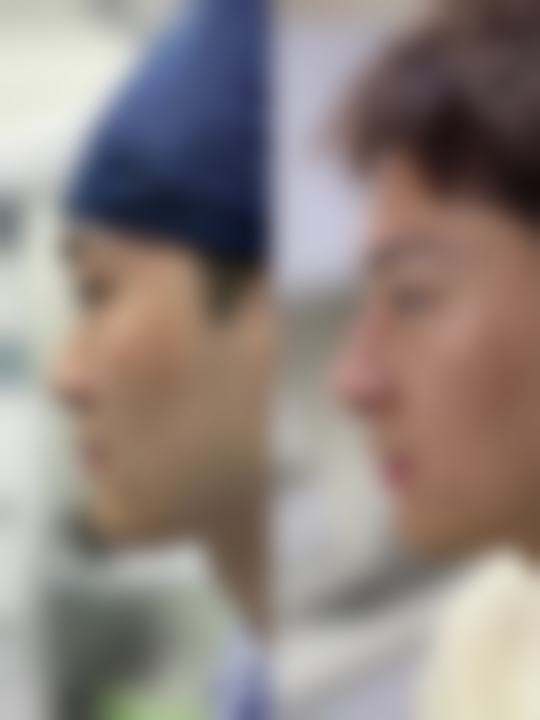 植入与调型:注入“灵魂”塑造理想形态