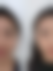 五、焦作丽人整形医院怎么预约: