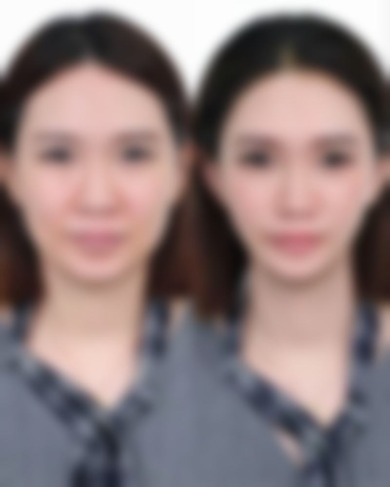 不同修复阶段的适用情况