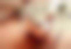 四、盘锦馥安医院整形外科实例