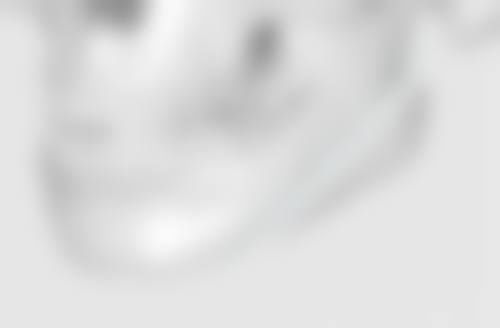 揭秘三：医美方案初体验，精细改善眼袋