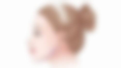 术后护理对纳米无痕双眼皮修复的重要性