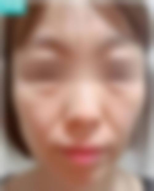 郭华峰项目价格表参考