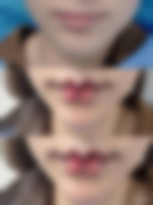 付晋凤烧伤整形水平怎么样可靠吗?