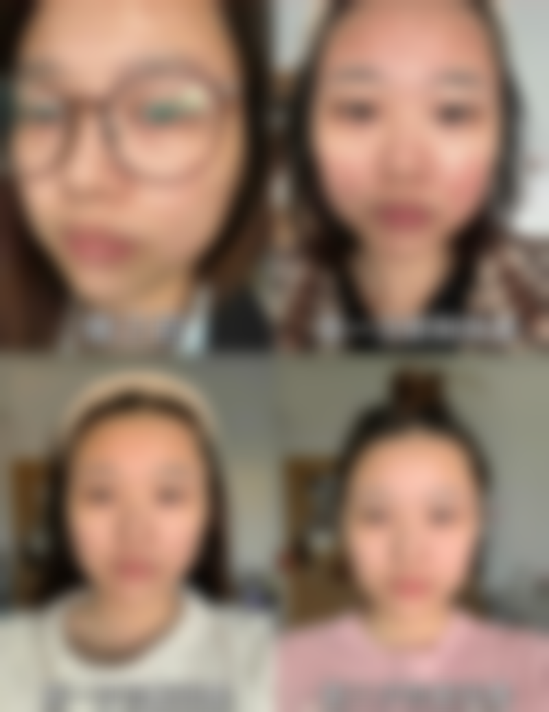 七、沈阳润然医疗美容门诊部价格表：（仅供参考）