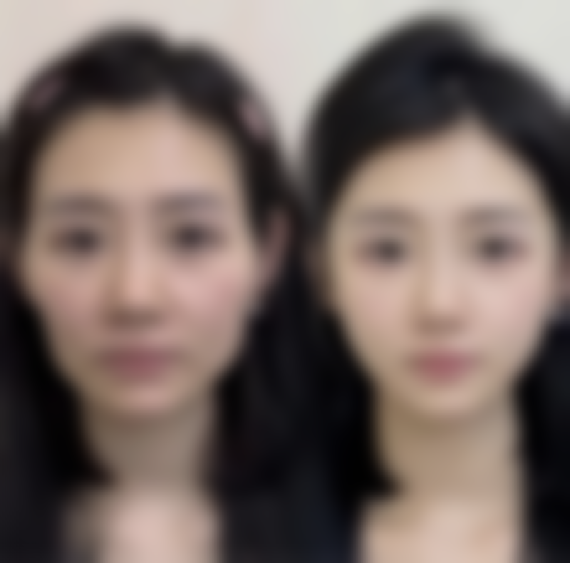 四、日照市皮肤病医院医学美容科实例