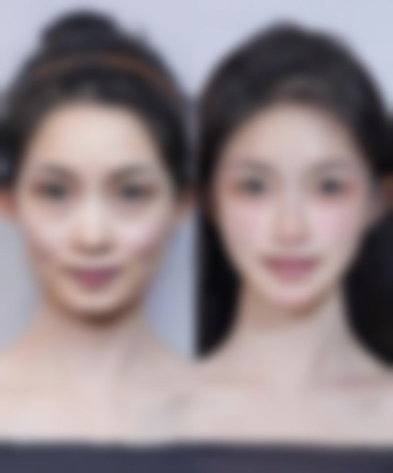 六、上饶双博士医疗美容门诊部价格表：（仅供参考）