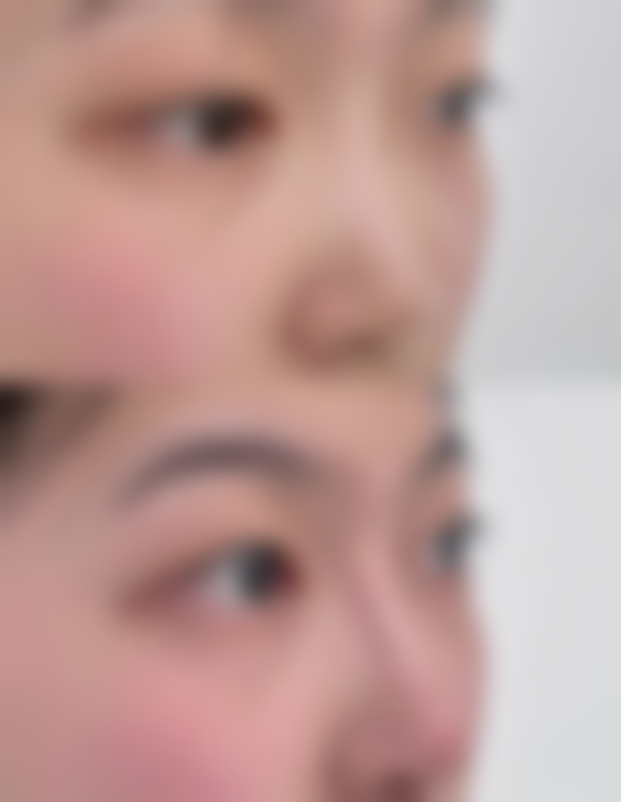 袁义晶美学双眼皮水平怎么样可靠吗?