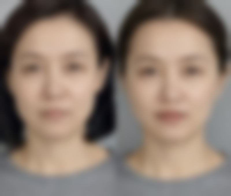 六、盘锦馥安医院整形外科价格表:(仅供参考)