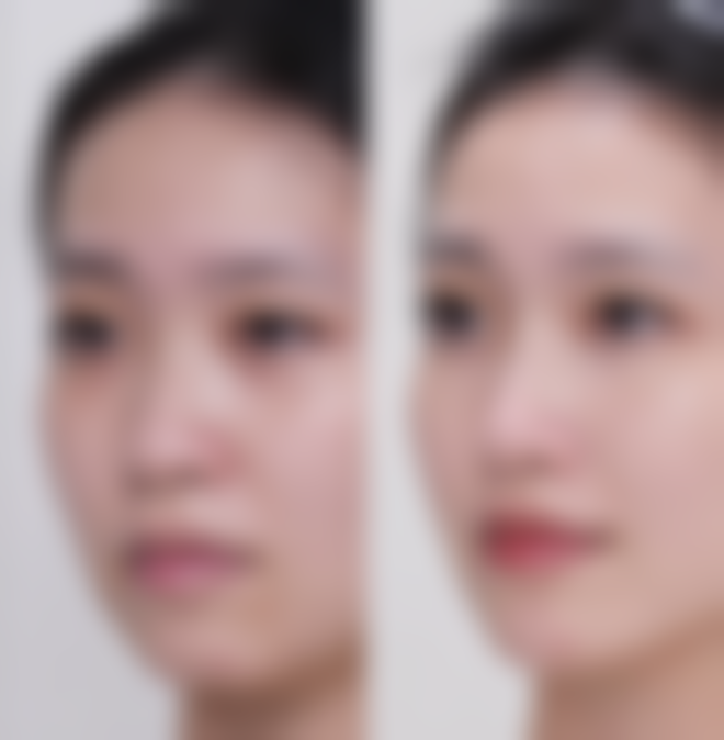 七、广州美杰医疗美容门诊部真实的顾客评价如下: