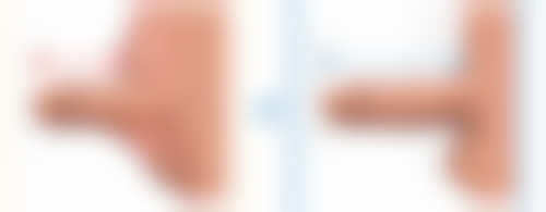 七、韩国江南Spine医院真实的顾客评价如下：