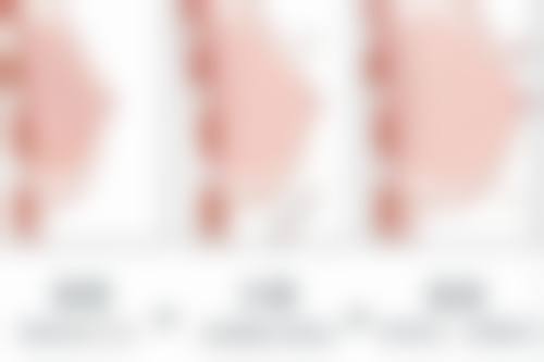 王元娥隆胸水平怎么样可靠吗？