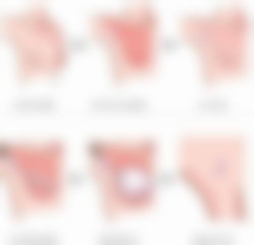 微创双眼皮虽非恒久，但美丽可以延续