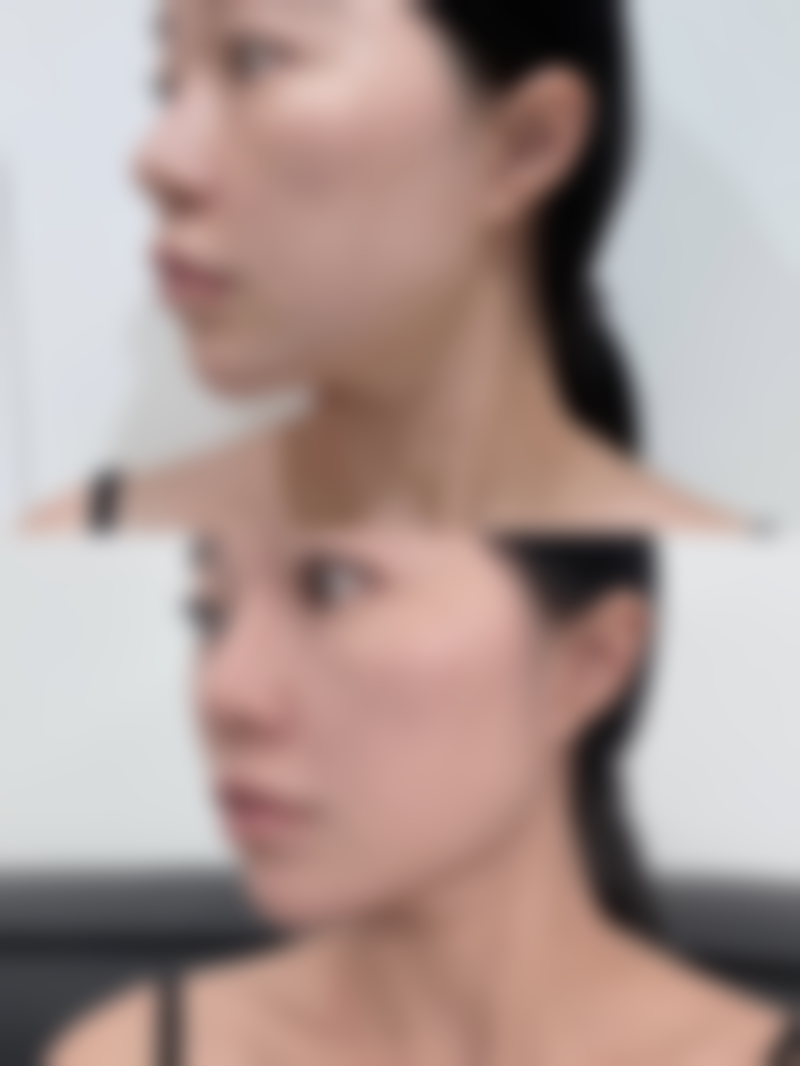 四、成都迦小美整形医院实例