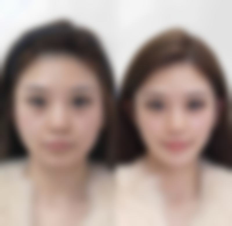 二、北京美泊医疗美容医院正规吗?来看看医院资质: