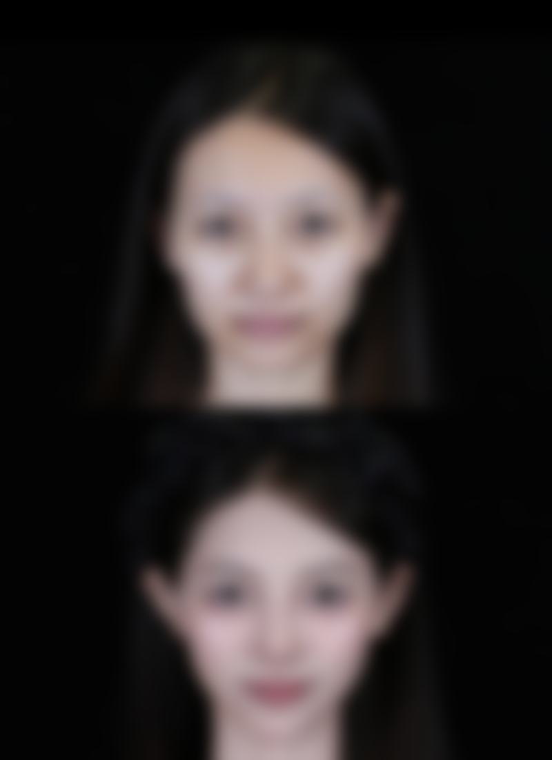 五、成都迦小美整形医院怎么预约：