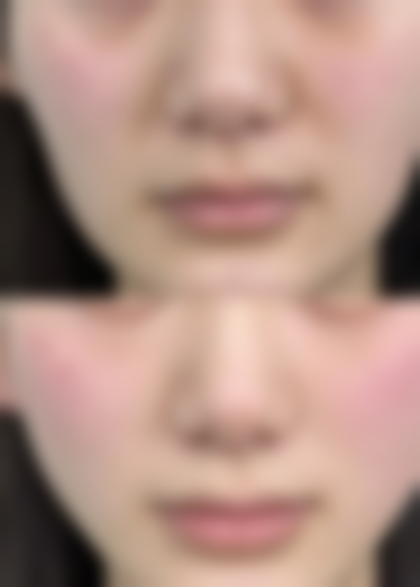 四、安阳苏莱美美容实例