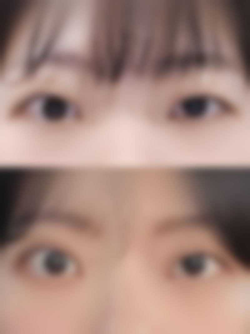 六、韩国BarbieFace整形外科怎么预约: