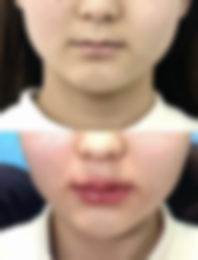 六、宁波茗星(丽星)医疗美容门诊部价格表:(仅供参考)