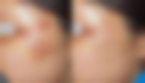 五、廊坊金荣医疗美容诊所怎么预约：