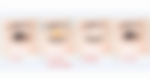 除皱针成效大揭秘：自然美观边界的精细把控