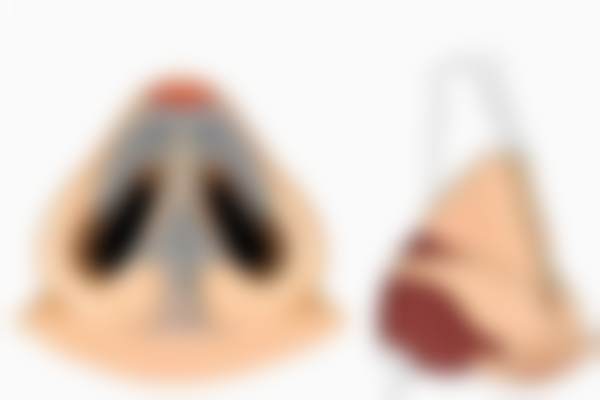 六、北京蕾士悦容门诊部乐普悦雅颜项目的成功实例展示