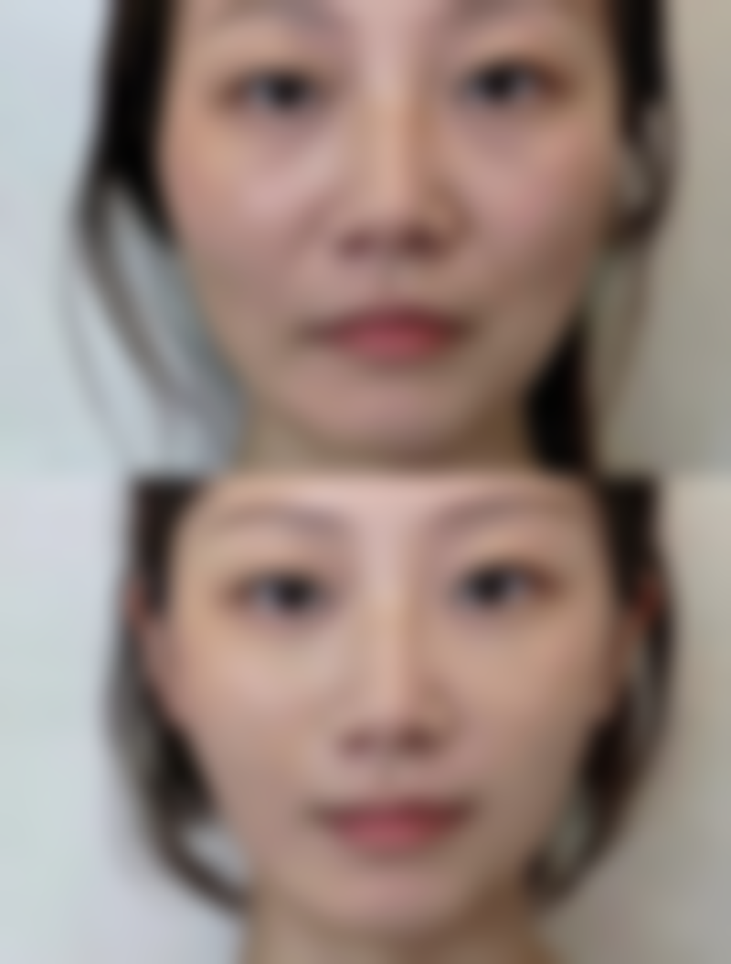 四、韩国利本韩整形美容中 心实例