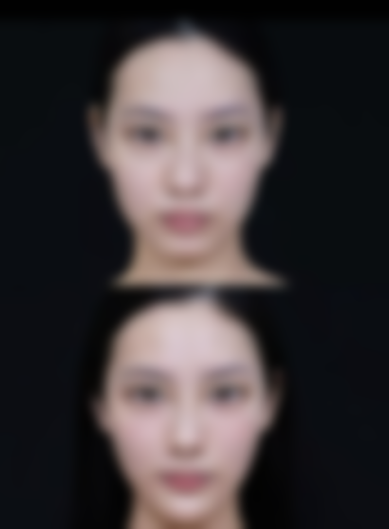 四、西安零点零医医疗美容实例