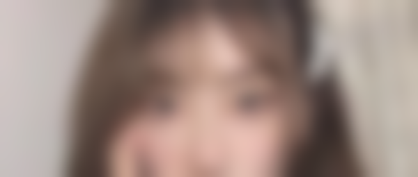 术后36天修复实录：眼睛变有神的快乐谁懂啊