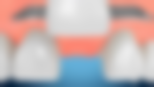 海口爱牙口腔医院矫正牙齿:个性化方案定制